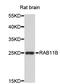 Ras-related protein Rab-11B antibody, STJ26432, St John