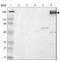 Tenascin C antibody, NBP1-89639, Novus Biologicals, Western Blot image 