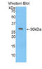 Interleukin 1 Receptor Associated Kinase 2 antibody, LS-C294799, Lifespan Biosciences, Western Blot image 
