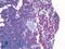 Linker For Activation Of T Cells antibody, LS-B2004, Lifespan Biosciences, Immunohistochemistry paraffin image 