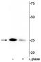 Troponin I3, Cardiac Type antibody, P01720-2, Boster Biological Technology, Western Blot image 