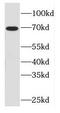 Fem-1 Homolog C antibody, FNab03074, FineTest, Western Blot image 