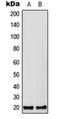 Cripto, FRL-1, Cryptic Family 1B antibody, orb215578, Biorbyt, Western Blot image 