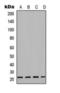 Troponin T1, Slow Skeletal Type antibody, orb393179, Biorbyt, Western Blot image 