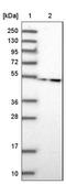 Tubulin Folding Cofactor E Like antibody, NBP2-34051, Novus Biologicals, Western Blot image 