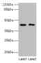BTB Domain Containing 6 antibody, LS-C211826, Lifespan Biosciences, Western Blot image 
