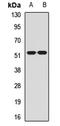 Muscarinic acetylcholine receptor M2 antibody, LS-C667912, Lifespan Biosciences, Western Blot image 