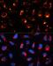 Keratin 18 antibody, LS-C746770, Lifespan Biosciences, Immunofluorescence image 