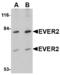 Transmembrane Channel Like 8 antibody, A06892-1, Boster Biological Technology, Western Blot image 