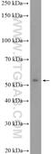 Serine And Arginine Rich Splicing Factor 6 antibody, 11772-1-AP, Proteintech Group, Western Blot image 