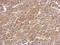 P21 (RAC1) Activated Kinase 6 antibody, GTX107861, GeneTex, Immunohistochemistry paraffin image 