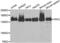 Tripeptidyl Peptidase 2 antibody, abx004914, Abbexa, Western Blot image 