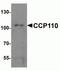 Centriolar Coiled-Coil Protein 110 antibody, NBP2-81976, Novus Biologicals, Western Blot image 