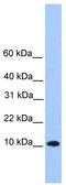 Trafficking Protein Particle Complex 6B antibody, TA337567, Origene, Western Blot image 