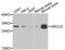 Ubiquitin Conjugating Enzyme E2 J2 antibody, A7316, ABclonal Technology, Western Blot image 