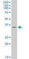 TPS1 antibody, H00007177-D01P, Novus Biologicals, Western Blot image 