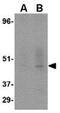 CD209 Molecule antibody, GTX84994, GeneTex, Western Blot image 