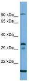 Transmembrane 6 superfamily member 2 antibody, TA335280, Origene, Western Blot image 