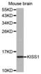 KiSS-1 Metastasis Suppressor antibody, MBS126500, MyBioSource, Western Blot image 