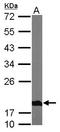 NADH:Ubiquinone Oxidoreductase Subunit S4 antibody, LS-C185721, Lifespan Biosciences, Western Blot image 