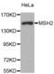MutS Homolog 2 antibody, abx001036, Abbexa, Western Blot image 