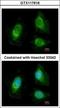 Exosome Component 2 antibody, GTX117616, GeneTex, Immunocytochemistry image 