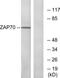 Zeta Chain Of T Cell Receptor Associated Protein Kinase 70 antibody, LS-C118279, Lifespan Biosciences, Western Blot image 