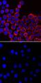 LCK Proto-Oncogene, Src Family Tyrosine Kinase antibody, MAB7500, R&D Systems, Immunocytochemistry image 