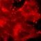 Protein Kinase C Alpha antibody, ab31, Abcam, Immunofluorescence image 