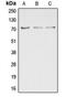 Dual Specificity Phosphatase 16 antibody, MBS821483, MyBioSource, Western Blot image 