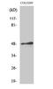 Transcription Factor AP-2 Alpha antibody, STJ91618, St John