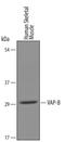 VAMP Associated Protein B And C antibody, PA5-47787, Invitrogen Antibodies, Western Blot image 