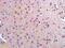 Programmed Cell Death 10 antibody, GTX51761, GeneTex, Immunohistochemistry paraffin image 