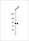 Coiled-Coil Alpha-Helical Rod Protein 1 antibody, 63-503, ProSci, Western Blot image 