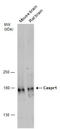 Contactin Associated Protein 1 antibody, GTX133272, GeneTex, Western Blot image 