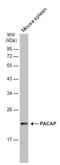 Marginal Zone B And B1 Cell Specific Protein antibody, GTX106794, GeneTex, Western Blot image 