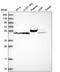 PMS1 Homolog 2, Mismatch Repair System Component antibody, PA5-65382, Invitrogen Antibodies, Western Blot image 