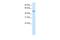 Zinc Finger Protein 823 antibody, A17046, Boster Biological Technology, Western Blot image 