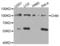 CHM Rab Escort Protein antibody, LS-B15524, Lifespan Biosciences, Western Blot image 