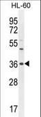 Olfactory Receptor Family 1 Subfamily J Member 4 antibody, LS-C163156, Lifespan Biosciences, Western Blot image 