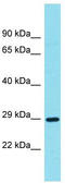 Meteorin Like, Glial Cell Differentiation Regulator antibody, TA334848, Origene, Western Blot image 