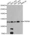 Transient Receptor Potential Cation Channel Subfamily M Member 8 antibody, STJ27286, St John