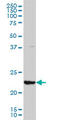 Glutathione S-Transferase Alpha 3 antibody, LS-B4337, Lifespan Biosciences, Western Blot image 