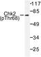 Checkpoint Kinase 2 antibody, LS-C177890, Lifespan Biosciences, Western Blot image 