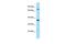 Iduronidase Alpha-L- antibody, PA5-45483, Invitrogen Antibodies, Western Blot image 