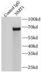 N-Myristoyltransferase 1 antibody, FNab05770, FineTest, Immunoprecipitation image 