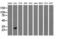 Glutathione S-Transferase Theta 2 (Gene/Pseudogene) antibody, LS-C115750, Lifespan Biosciences, Western Blot image 