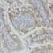 Alpha-1,3-Mannosyl-Glycoprotein 4-Beta-N-Acetylglucosaminyltransferase A antibody, FNab05159, FineTest, Immunohistochemistry frozen image 