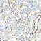 Hyaluronidase 1 antibody, GTX64626, GeneTex, Immunohistochemistry paraffin image 