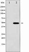 GFAP antibody, TA327848, Origene, Western Blot image 